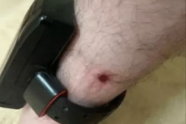 EX-VEREADOR TENTA RETIRAR TORNOZELEIRA APÓS ALEGAÇÕES DE PREJUÍZO