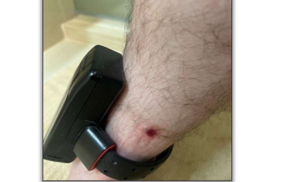 Pecuarista Claudinho pede liberdade em nova ação na Justiça por feridas na perna